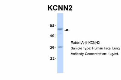 Western Blot: KCNN2 Antibody [NBP2-84112]