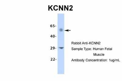 Western Blot: KCNN2 Antibody [NBP2-84112]