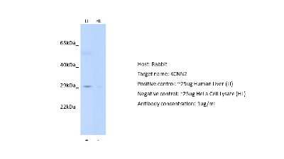 Western Blot: KCNN2 Antibody [NBP2-84112]