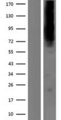 Western Blot: KCNN2 Overexpression Lysate [NBP2-05206]