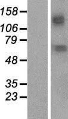 Western Blot: KCNN2 Overexpression Lysate [NBP2-06528]