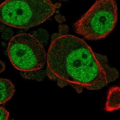 Immunocytochemistry/ Immunofluorescence: KCNN3 Antibody [NBP2-55459]