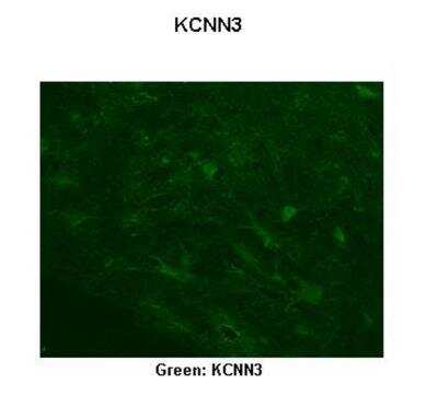 Immunohistochemistry: KCNN3 Antibody [NBP2-85137]
