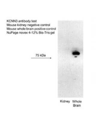 Western Blot: KCNN3 Antibody [NBP2-85137]