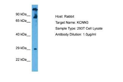 Western Blot: KCNN3 Antibody [NBP2-85137]