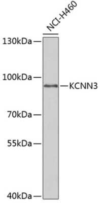 Western Blot: KCNN3 AntibodyBSA Free [NBP3-04878]