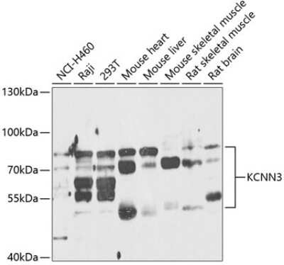 Western Blot: KCNN3 AntibodyAzide and BSA Free [NBP3-04879]