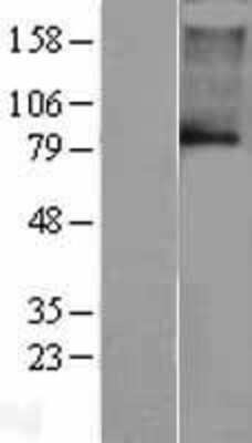 Western Blot: KCNN3 Overexpression Lysate [NBL1-12195]