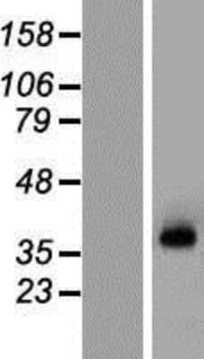 Western Blot: KCNN3 Overexpression Lysate [NBP2-05209]