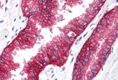 Immunohistochemistry-Paraffin: KCNN4 Antibody [NBP3-14383]