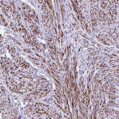 Immunohistochemistry-Paraffin: KCNN4 Antibody [NBP2-32484]