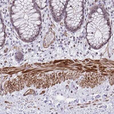 Immunohistochemistry-Paraffin: KCNN4 Antibody [NBP2-33694]