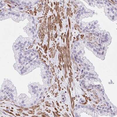 Immunohistochemistry-Paraffin: KCNN4 Antibody [NBP2-33694]