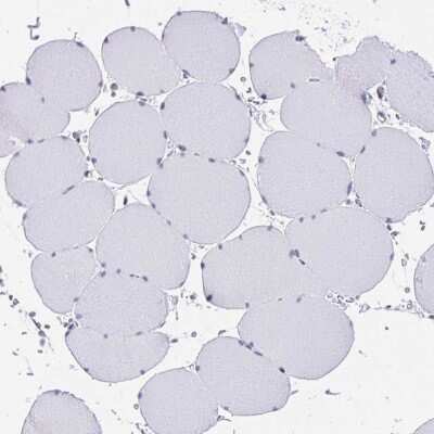 Immunohistochemistry-Paraffin: KCNN4 Antibody [NBP2-33694]