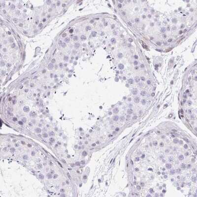 Immunohistochemistry-Paraffin: KCNN4 Antibody [NBP2-33694]