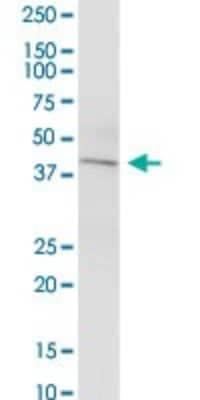 Western Blot: KCNN4 Antibody [H00003783-B01P]