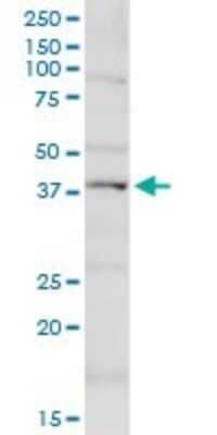 Western Blot: KCNN4 Antibody [H00003783-D01P]