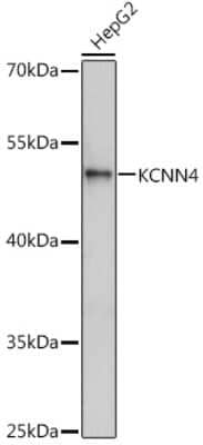 Western Blot: KCNN4 AntibodyAzide and BSA Free [NBP3-04926]