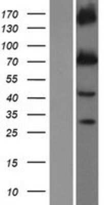 Western Blot: Kv7.1 Overexpression Lysate [NBP2-09069]