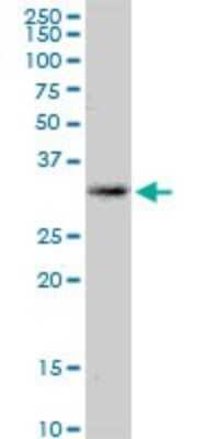 Western Blot: KCNRG Antibody [H00283518-B01P]