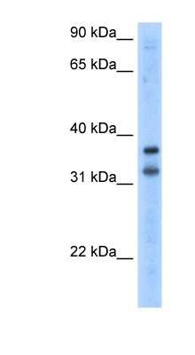 Western Blot: KCNRG Antibody [NBP1-80108]