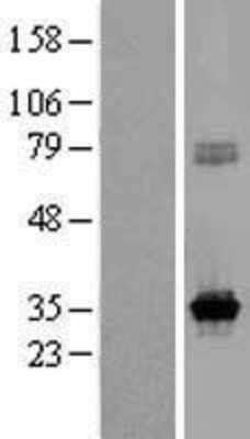 Western Blot: KCNRG Overexpression Lysate [NBP2-10099]