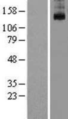 Western Blot: KCNT1 Overexpression Lysate [NBL1-12204]