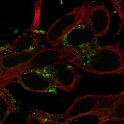 Immunocytochemistry/ Immunofluorescence: KCNT2 Antibody [NBP2-14146]