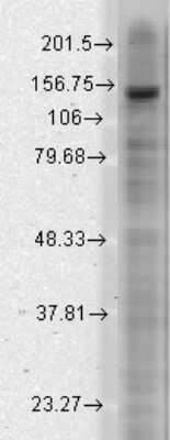 Western Blot: KCNT2 Antibody (S11-33) [NBP1-47606]