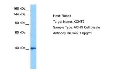 Western Blot: KCNT2 Antibody [NBP2-85138]