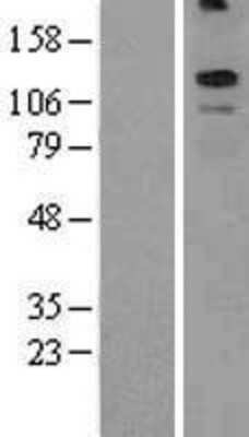 Western Blot: KCNT2 Overexpression Lysate [NBL1-12205]