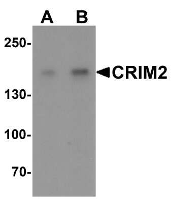 Western Blot: KCP AntibodyBSA Free [NBP2-81728]