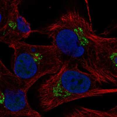 Immunocytochemistry/ Immunofluorescence: KCT2 Antibody [NBP2-55245]