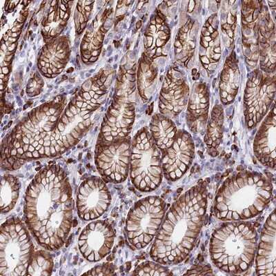 Immunohistochemistry-Paraffin: KCT2 Antibody [NBP1-93682]