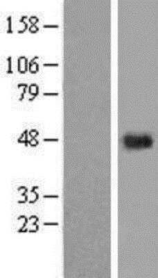 Western Blot: KCT2 Overexpression Lysate [NBP2-06683]