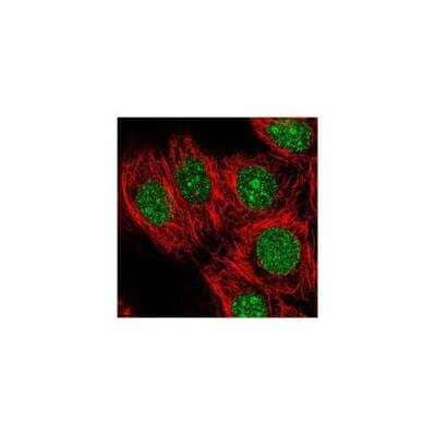 Immunocytochemistry/ Immunofluorescence: KCTD1 Antibody [NBP3-17507]