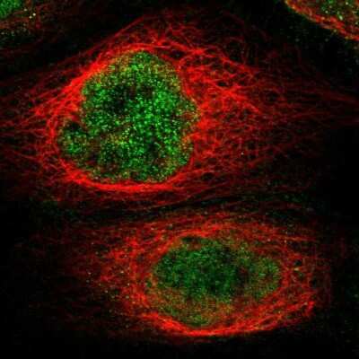 Immunocytochemistry/ Immunofluorescence: KCTD10 Antibody [NBP1-81023]