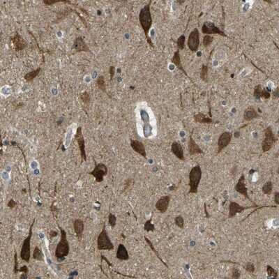 Immunohistochemistry-Paraffin: KCTD10 Antibody [NBP1-81023]