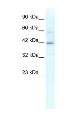 Western Blot: KCTD10 Antibody [NBP1-80086]