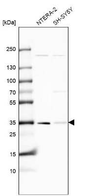 Western Blot: KCTD10 Antibody [NBP1-81023]