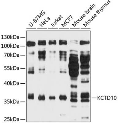 Western Blot: KCTD10 AntibodyAzide and BSA Free [NBP3-04463]