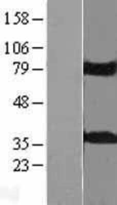 Western Blot: KCTD10 Overexpression Lysate [NBL1-12207]