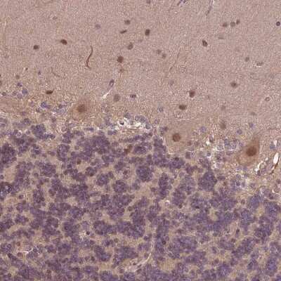 Immunohistochemistry-Paraffin: KCTD11 Antibody [NBP2-47412]