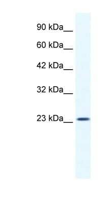 Western Blot: KCTD11 Antibody [NBP1-80211]