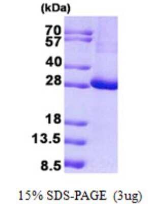 SDS-PAGE: Recombinant Human KCTD11 His Protein [NBP2-23352]