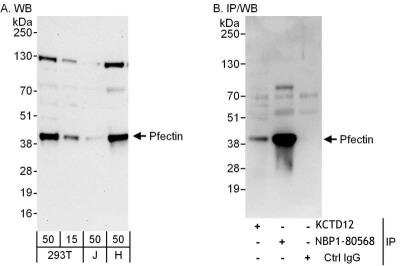 Immunoprecipitation: KCTD12 Antibody [NBP1-80568]