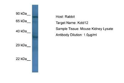 Western Blot: KCTD12 Antibody [NBP2-84114]