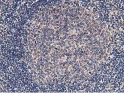 Immunohistochemistry-Paraffin: KCTD14 Antibody (OTI1D11) [NBP2-00470]
