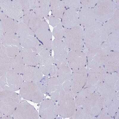 Immunohistochemistry-Paraffin: KCTD14 Antibody [NBP1-92042]