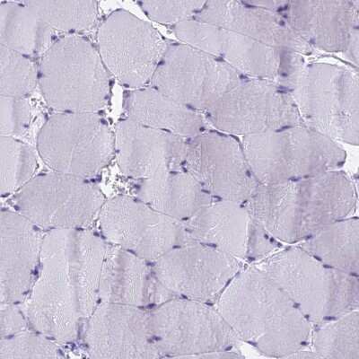 Immunohistochemistry-Paraffin: KCTD14 Antibody [NBP1-92043]